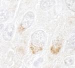 GBF1 Polyclonal Antibody