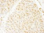 ANKRD17 Antibody in Immunohistochemistry (Paraffin) (IHC (P))