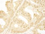 ANKRD17 Polyclonal Antibody