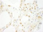 PRPF4B Antibody in Immunohistochemistry (Paraffin) (IHC (P))