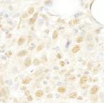 CROP/Luc7A Polyclonal Antibody