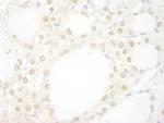 WDR20 Polyclonal Antibody