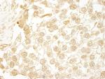 WDR20 Antibody in Immunohistochemistry (Paraffin) (IHC (P))