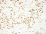 CDC5L Antibody in Immunohistochemistry (Paraffin) (IHC (P))