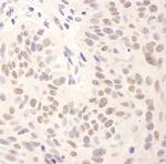 BMI1 Antibody in Immunohistochemistry (Paraffin) (IHC (P))