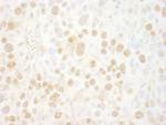 BMI1 Polyclonal Antibody