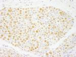 ZNF198 Polyclonal Antibody