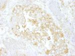 Cdc42GAP Antibody in Immunohistochemistry (Paraffin) (IHC (P))