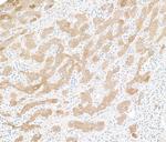 Human C-Reactive Protein (CRP) Polyclonal Antibody
