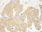 GRB10 Polyclonal Antibody