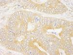 GRB10 Antibody in Immunohistochemistry (Paraffin) (IHC (P))