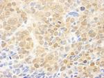 MEK1 Antibody in Immunohistochemistry (Paraffin) (IHC (P))
