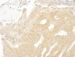 MEK2 Antibody in Immunohistochemistry (Paraffin) (IHC (P))