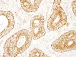 MADD Antibody in Immunohistochemistry (Paraffin) (IHC (P))