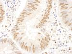 FANCD2 Antibody in Immunohistochemistry (Paraffin) (IHC (P))