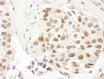 FANCD2 Antibody in Immunohistochemistry (Paraffin) (IHC (P))