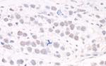 ARID2 Antibody in Immunohistochemistry (Paraffin) (IHC (P))