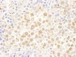 DDX27 Antibody in Immunohistochemistry (Paraffin) (IHC (P))