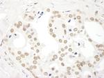 DDX27 Antibody in Immunohistochemistry (Paraffin) (IHC (P))