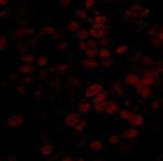 BCCIP Antibody in Immunohistochemistry (Paraffin) (IHC (P))