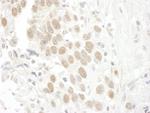 BCCIP Polyclonal Antibody