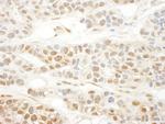 MKL1 Polyclonal Antibody