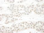 hSET1B Antibody in Immunohistochemistry (Paraffin) (IHC (P))
