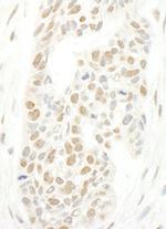 CAP-H2 Polyclonal Antibody