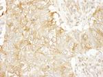 SASH1 Antibody in Immunohistochemistry (Paraffin) (IHC (P))