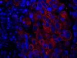 SASH1 Polyclonal Antibody