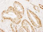 TIGAR Polyclonal Antibody