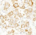 CKAP4 Antibody in Immunohistochemistry (Paraffin) (IHC (P))