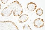 CKAP4 Antibody in Immunohistochemistry (Paraffin) (IHC (P))