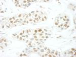 TFIIS Polyclonal Antibody