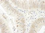 NOPP140 Polyclonal Antibody