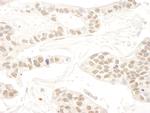 RBM34 Polyclonal Antibody