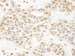 Pc2 Antibody in Immunohistochemistry (Paraffin) (IHC (P))