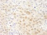 Pc2 Antibody in Immunohistochemistry (Paraffin) (IHC (P))