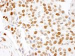 HMGN1 Antibody in Immunohistochemistry (Paraffin) (IHC (P))