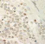 PRCC Antibody in Immunohistochemistry (Paraffin) (IHC (P))