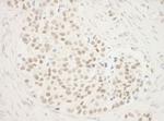 ZNF768 Polyclonal Antibody