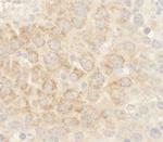 BAD Polyclonal Antibody