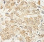 MED15 Antibody in Immunohistochemistry (Paraffin) (IHC (P))