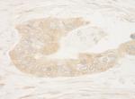 RSK1 Antibody in Immunohistochemistry (Paraffin) (IHC (P))