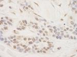 TORC3 Polyclonal Antibody