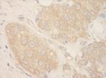 SRPK2 Antibody in Immunohistochemistry (Paraffin) (IHC (P))