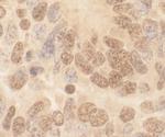 Cul2 Antibody in Immunohistochemistry (Paraffin) (IHC (P))