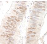 MBD3 Antibody in Immunohistochemistry (Paraffin) (IHC (P))