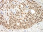 MBD3 Polyclonal Antibody