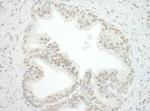 CBX7 Polyclonal Antibody